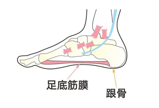 长时间用足需小心足底筋膜炎，穿着矫正鞋垫助缓解_新闻热点
